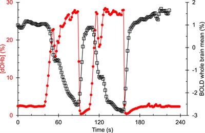 Transfer function analysis assesses resting cerebral perfusion metrics using hypoxia-induced deoxyhemoglobin as a contrast agent